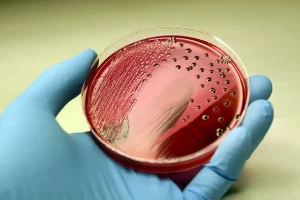 장티푸스 파라티푸스Typhoid_bacteria